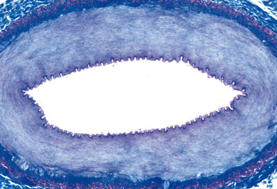 artéria de coelho coloração de rotina