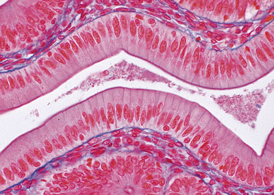 epitélio intestino delgado
