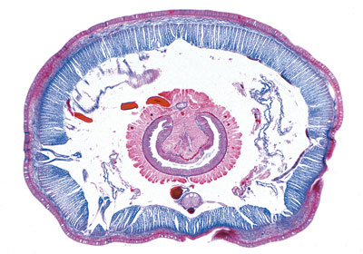 Lumbricus região de tiflossole