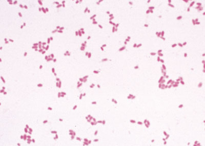 bactéria intestinal escherichia coli