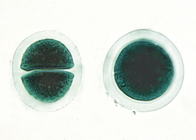 chroococcus-alga-unicelular