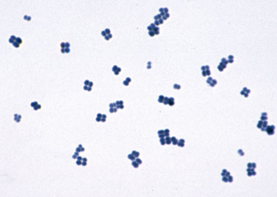 gaffkya tetragena em arranjo de quatro células
