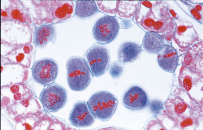 lilium antera célula mãe dos micróporos