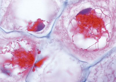 lilium célula mãe de micrósporo primeira divisão