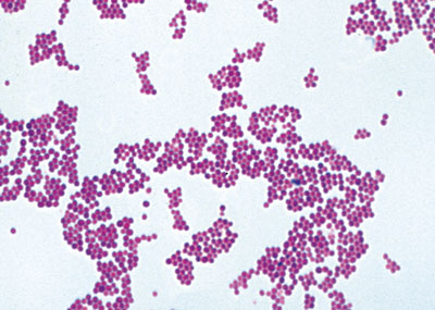 staphylococcus aureus organismo do pus